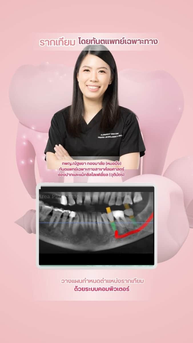 The Area Plus Dental Clinic — โคราช (4)