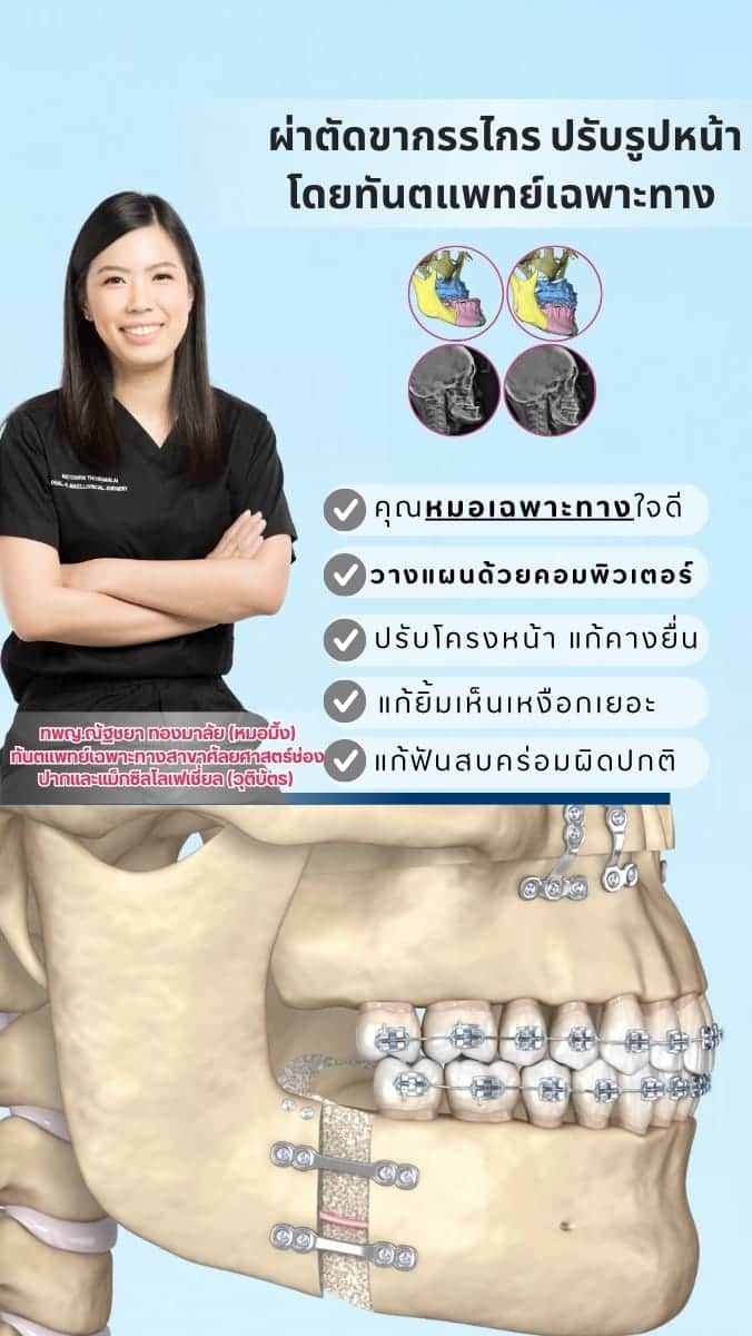 The Area Plus Dental Clinic — โคราช (8)