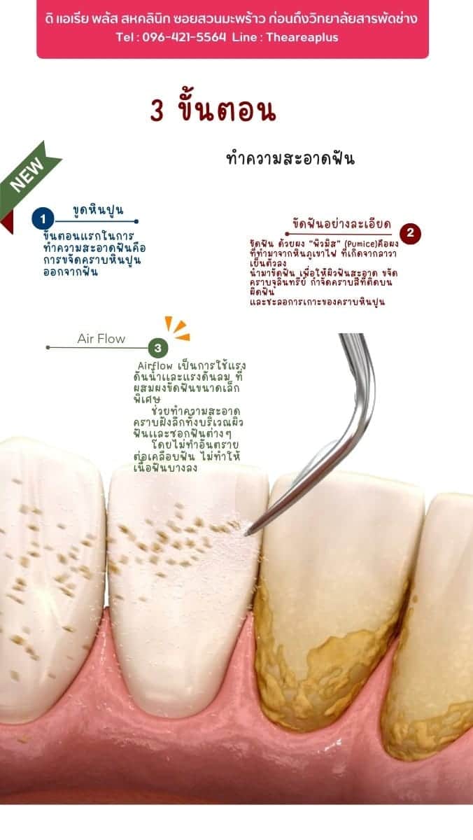 The Area Plus Dental Clinic — โคราช (10)