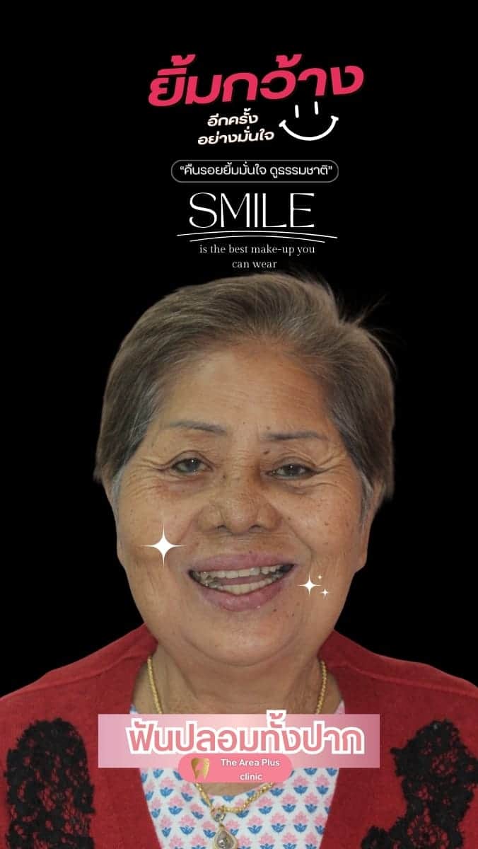 The Area Plus Dental Clinic — โคราช (14)