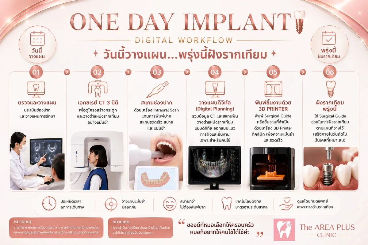รากเทียมภายใน 1 วัน