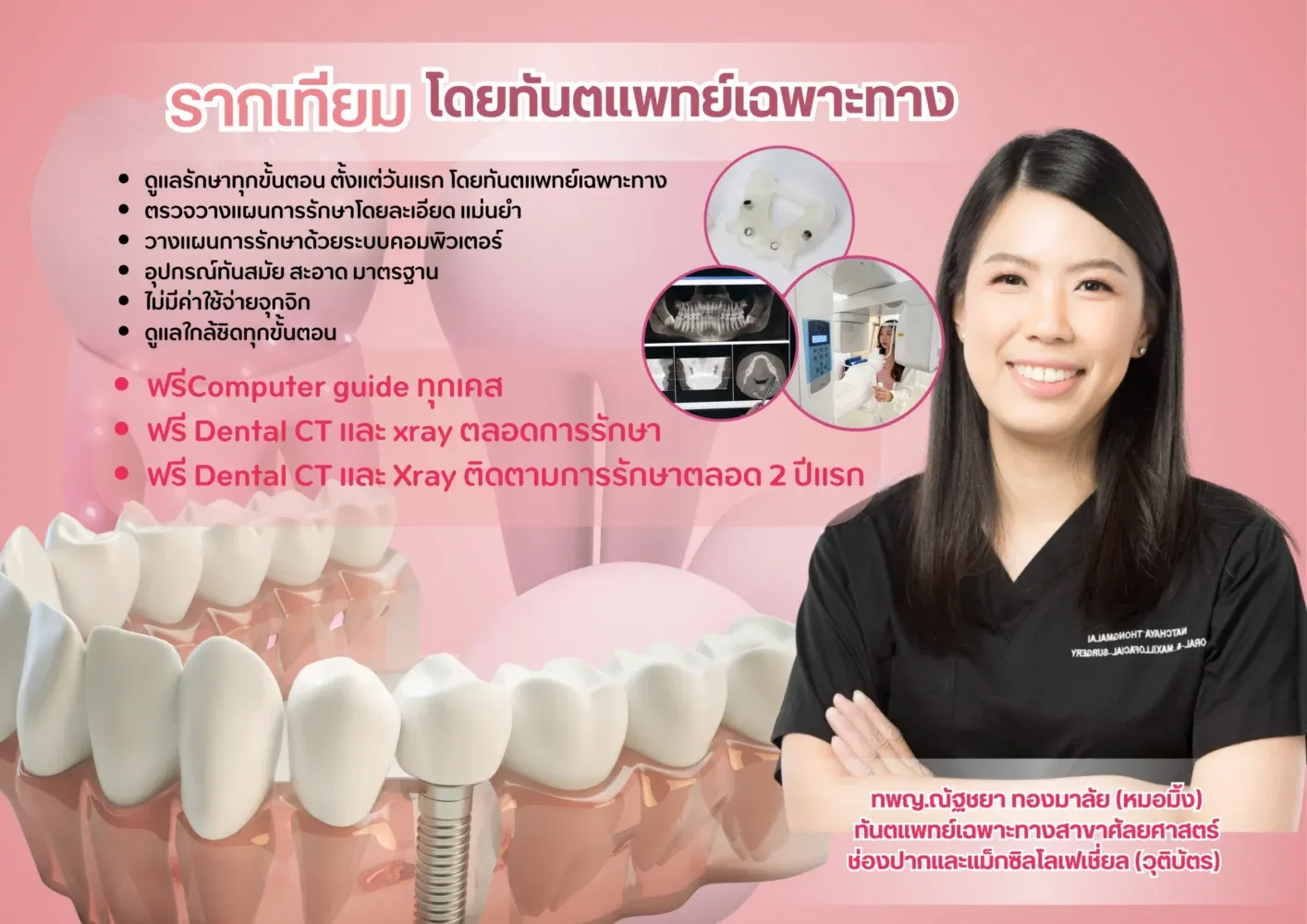 ภาพโปรโมชันรากฟันเทียมโดยทันตแพทย์เฉพาะทาง ทพญ.ณัฐชยา ทองมาลัย (หมอมิ้ง) ระบุฟรี Computer guide ทุกเคส พร้อม Dental CT และ X-ray ตลอดการรักษา