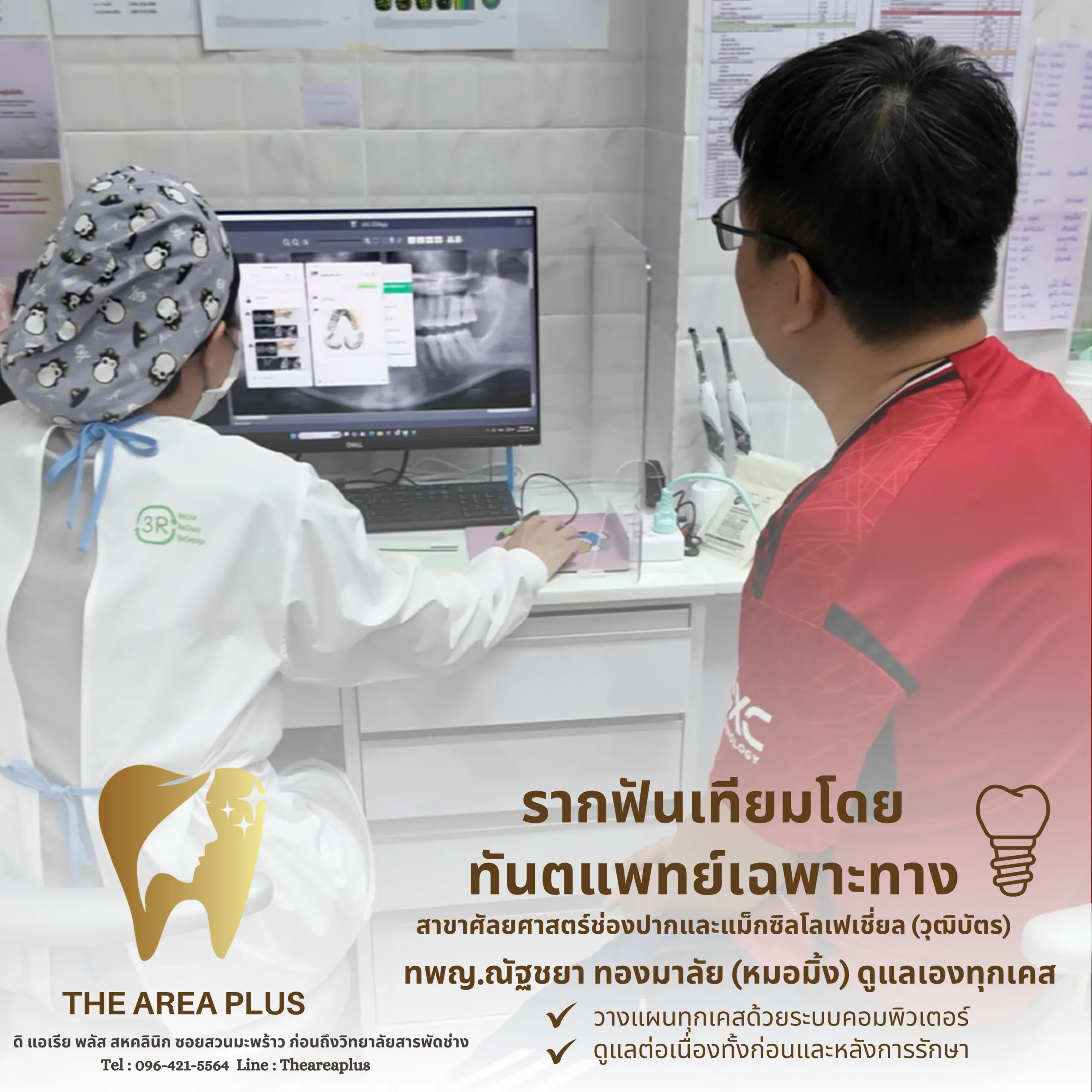 ทันตแพทย์และคนไข้ชายดูฟิล์มเอกซเรย์พาโนรามาบนจอคอมพิวเตอร์เพื่อวางแผนรากฟันเทียม พร้อมข้อความรากฟันเทียมโดยทันตแพทย์เฉพาะทาง ทพญ.ณัฐชยา ทองมาลัย (หมอมิ้ง)
