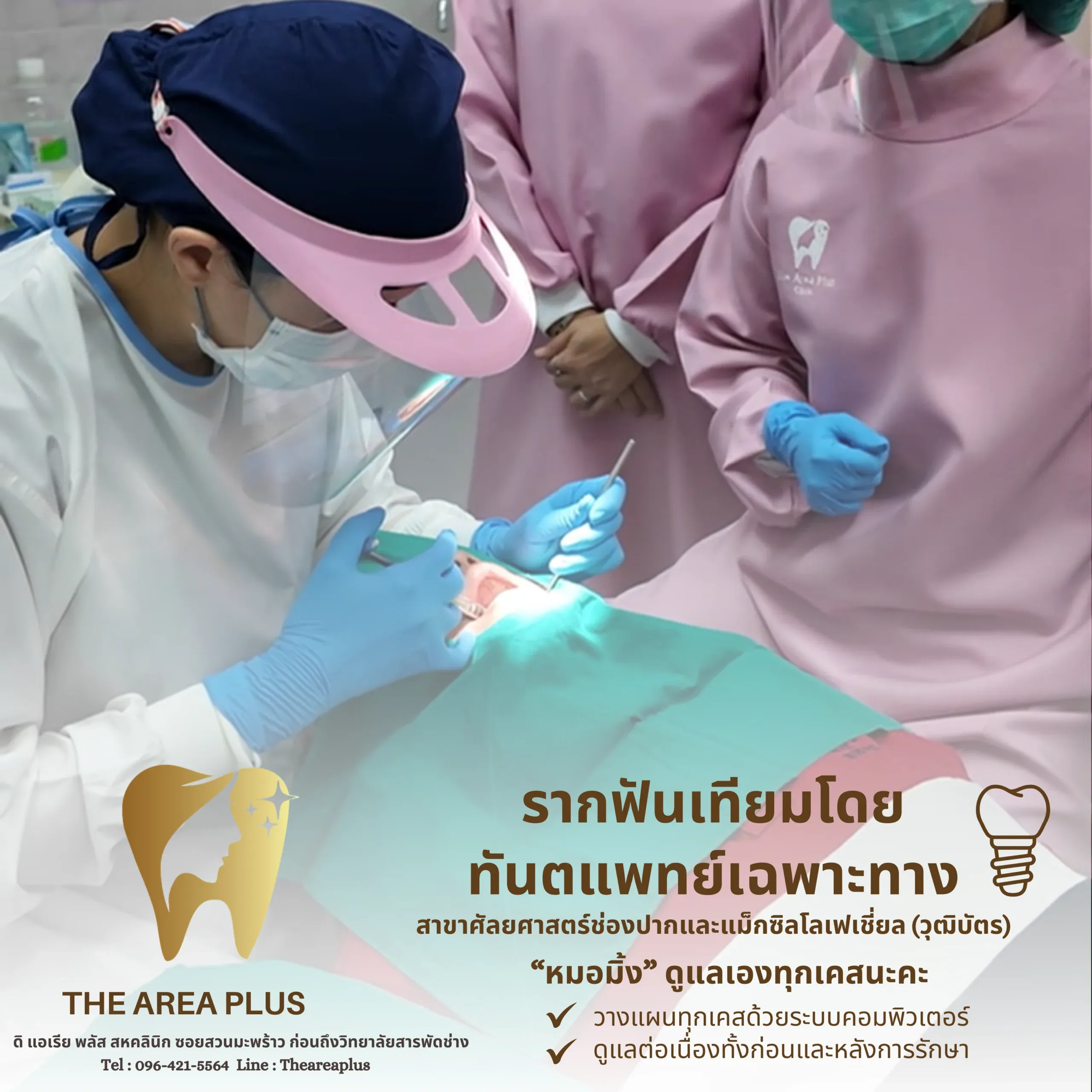 ทันตแพทย์ใช้ไฟส่องช่องปากคนไข้ระหว่างการฝังรากฟันเทียม โดยมีผู้ช่วยสองคนช่วยดูแล พร้อมข้อความรากฟันเทียมโดยทันตแพทย์เฉพาะทาง ทพญ.ณัฐชยา ทองมาลัย (หมอมิ้ง)