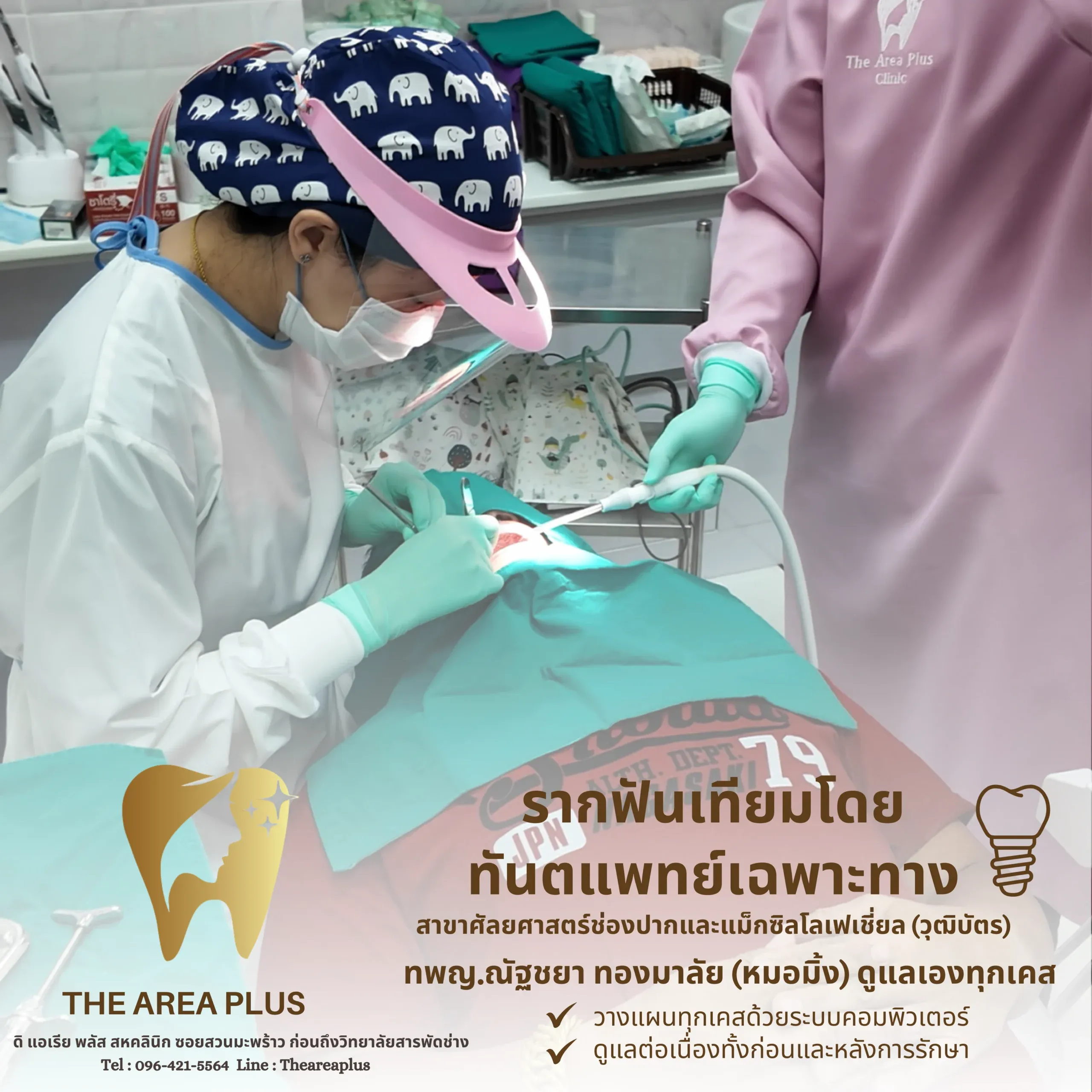 ทันตแพทย์และผู้ช่วยกำลังทำหัตถการรากฟันเทียมให้คนไข้ที่คลุมผ้าปลอดเชื้อ พร้อมข้อความรากฟันเทียมโดยทันตแพทย์เฉพาะทาง ทพญ.ณัฐชยา ทองมาลัย (หมอมิ้ง)