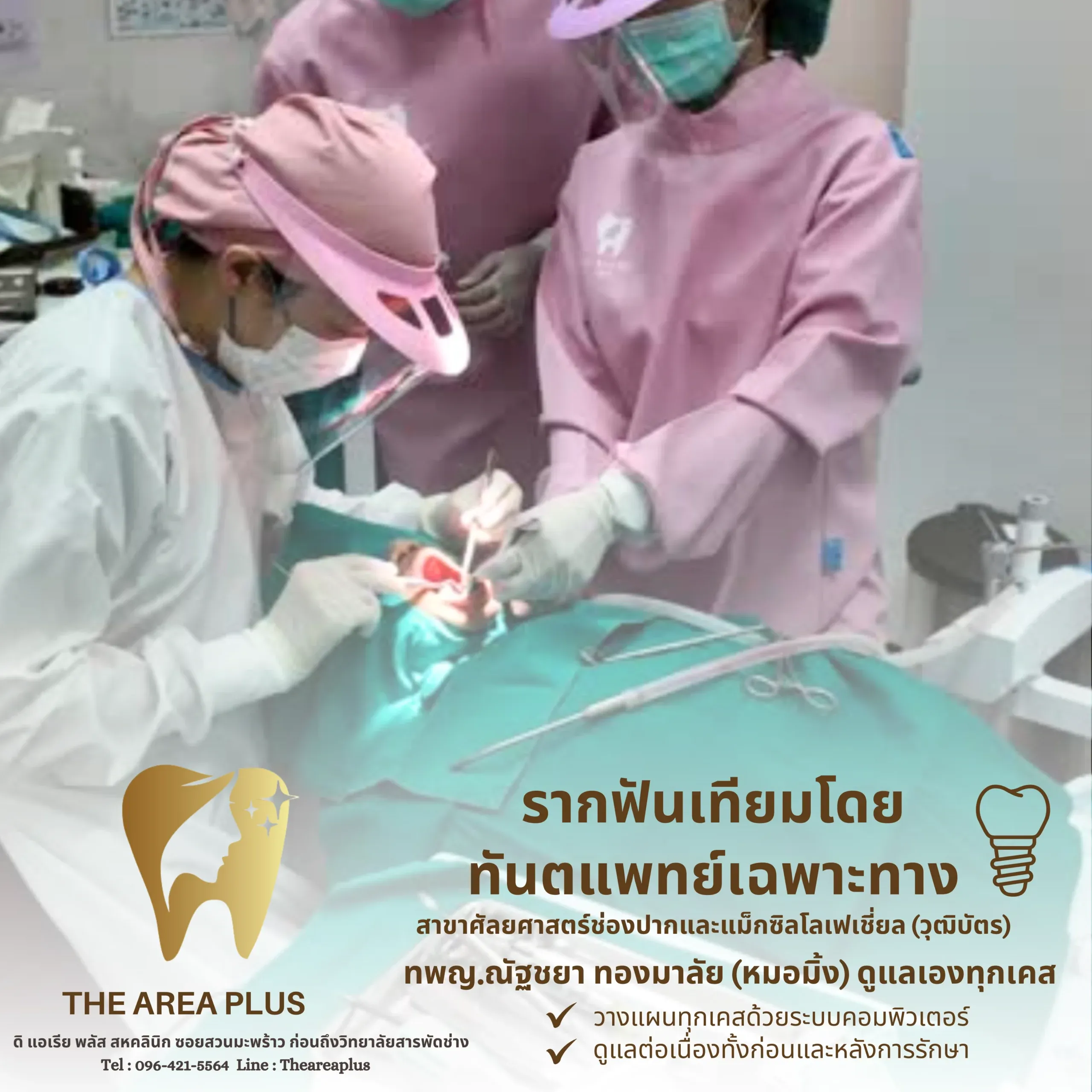 ทันตแพทย์และผู้ช่วยกำลังฝังรากฟันเทียมให้คนไข้ในห้องผ่าตัด พร้อมข้อความรากฟันเทียมโดยทันตแพทย์เฉพาะทาง ทพญ.ณัฐชยา ทองมาลัย (หมอมิ้ง)