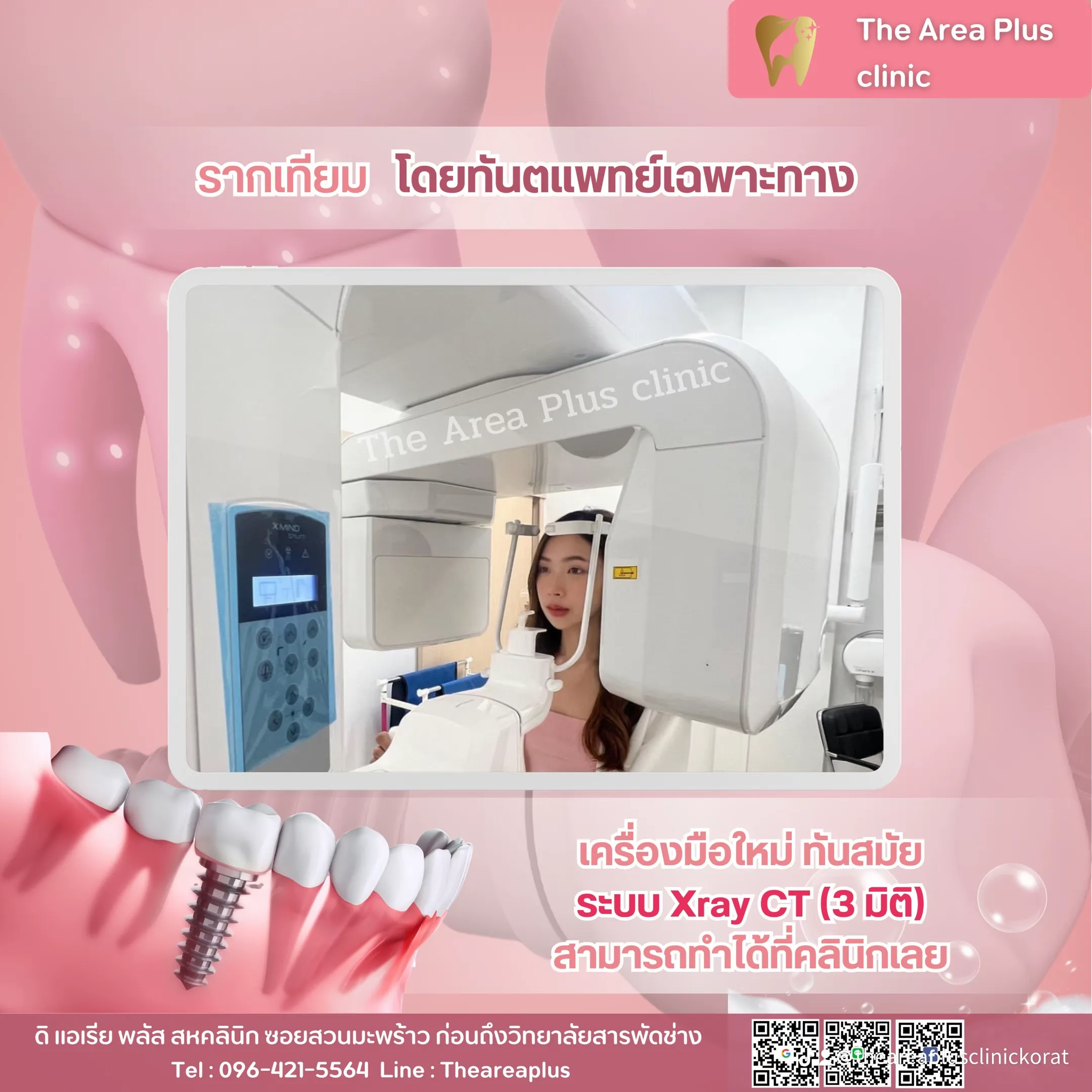 คนไข้ยืนถ่ายเอกซเรย์ด้วยเครื่อง X-ray CT สามมิติที่คลินิก พร้อมข้อความเครื่องมือใหม่ทันสมัย ทำได้ที่คลินิก