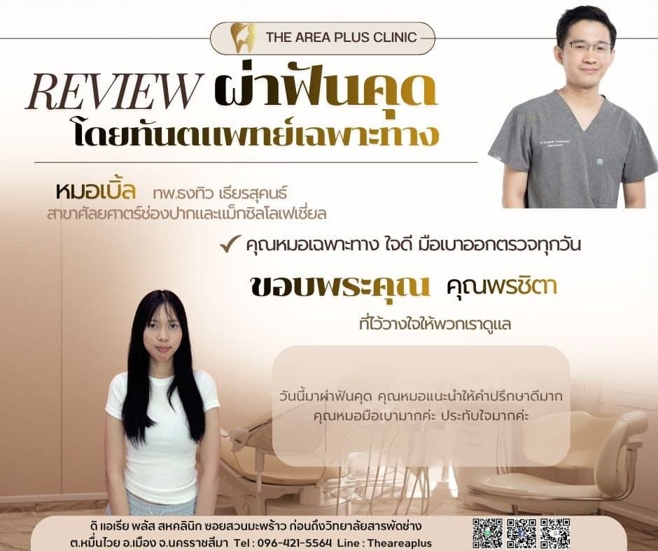 การ์ดรีวิวผ่าฟันคุดโดยหมอเบิ้ล ทพ.ธงทิว เธียรสุคนธ์ พร้อมภาพและคำบอกเล่าของคนไข้หญิงผมยาวในเสื้อยืดสีขาว
