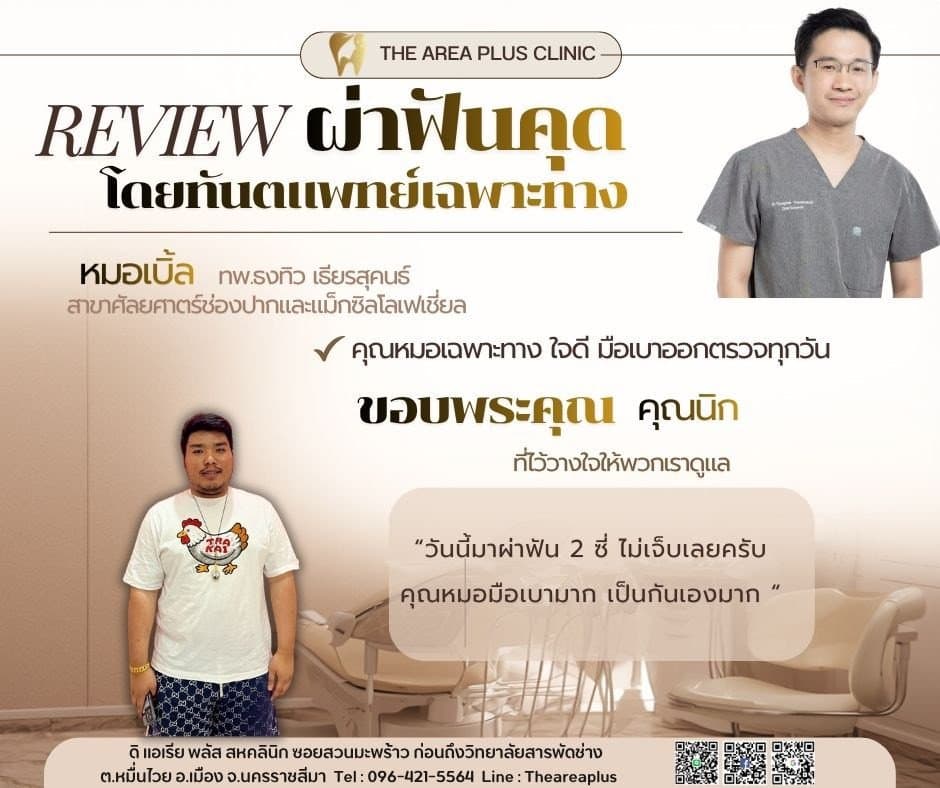 การ์ดรีวิวผ่าฟันคุดโดยหมอเบิ้ล ทพ.ธงทิว เธียรสุคนธ์ พร้อมภาพและคำบอกเล่าของคนไข้ชายในเสื้อยืดสีขาวที่มาผ่าฟันคุดสองซี่