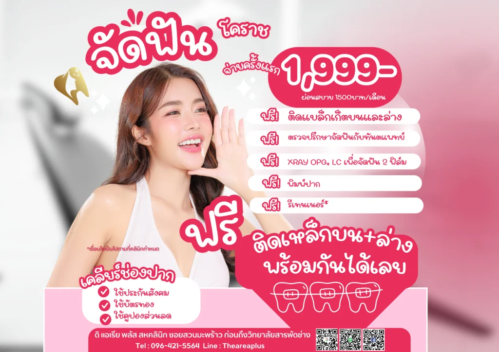 จัดฟันแบบโลหะ จัดฟันแบบโลหะ
