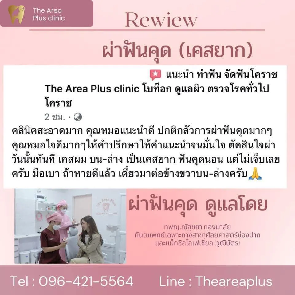 ผ่าฟันคุด รีวิวผ่าฟันคุดเคสยาก