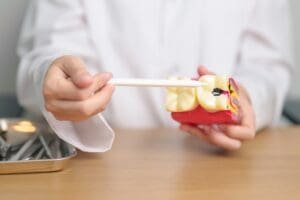 บริการถอนฟัน ฟันแตกต้องทํายังไง