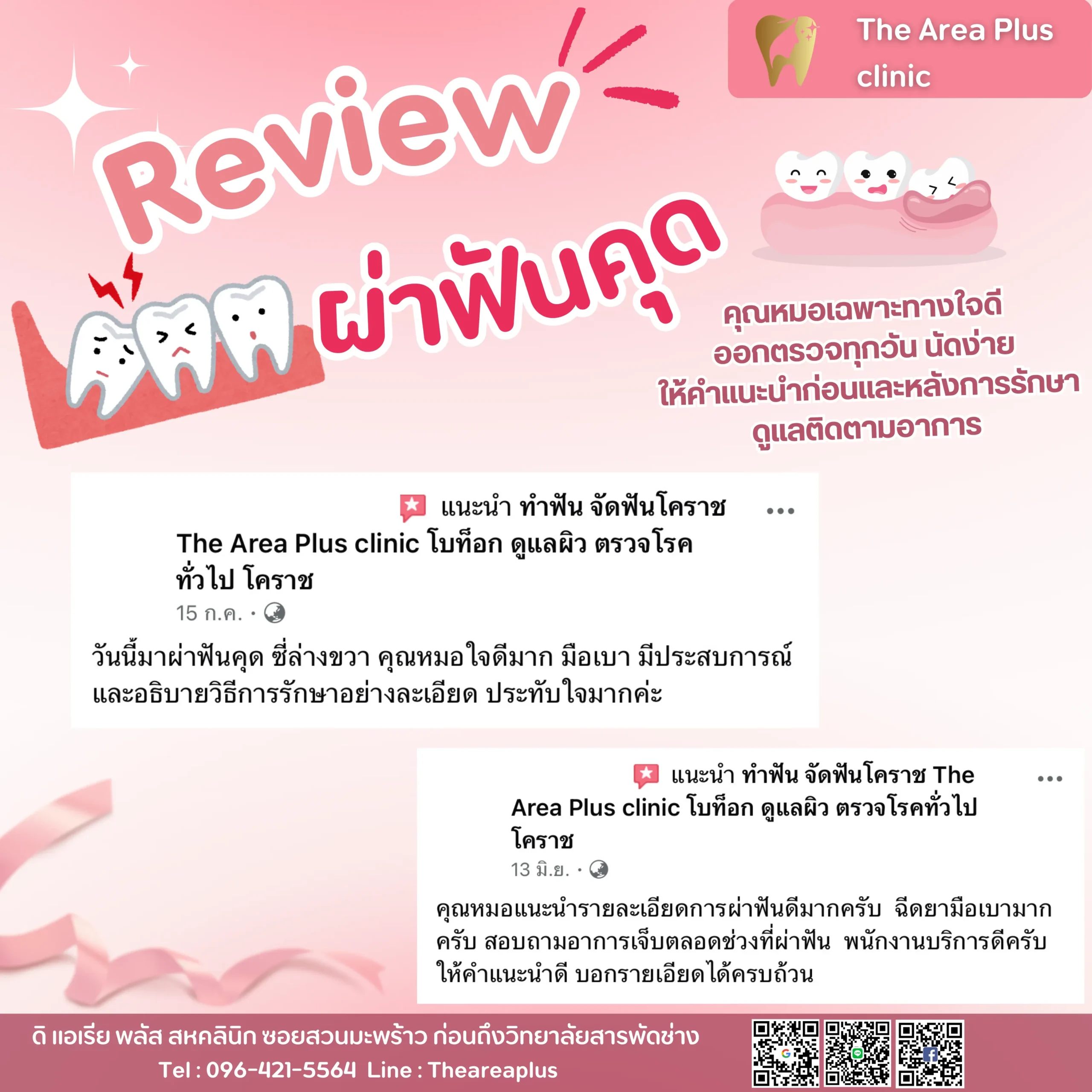 ผ่าฟันคุด รีวิวผ่าฟันคุด.zip - 10_result