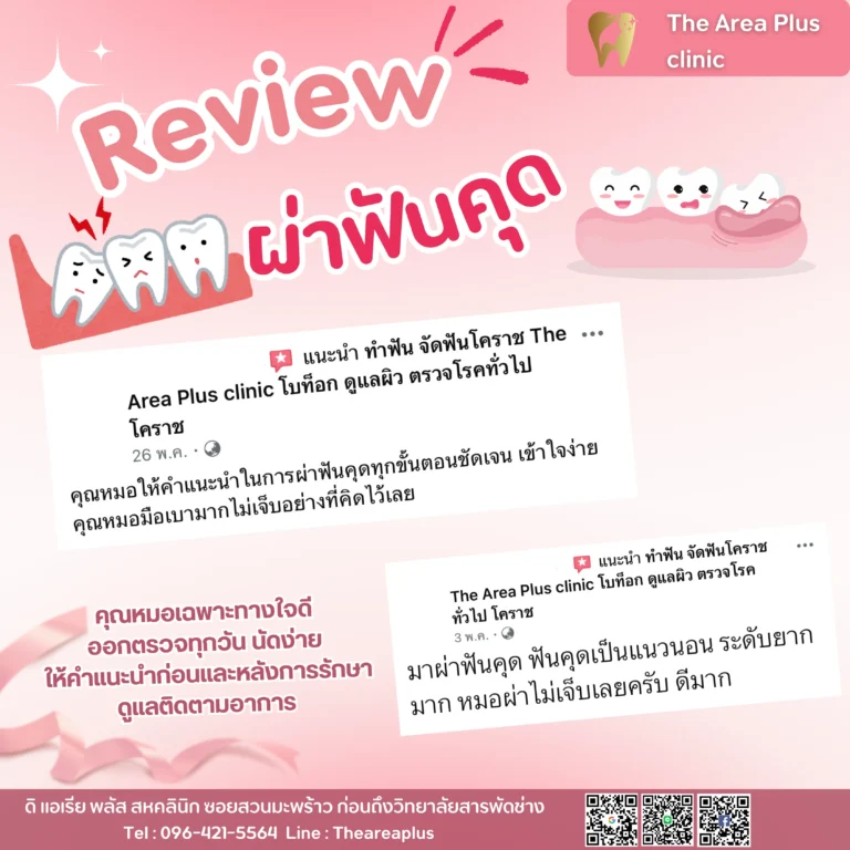คลินิกทันตกรรมเฉพาะทางโคราช รีวิวผ่าฟันคุด