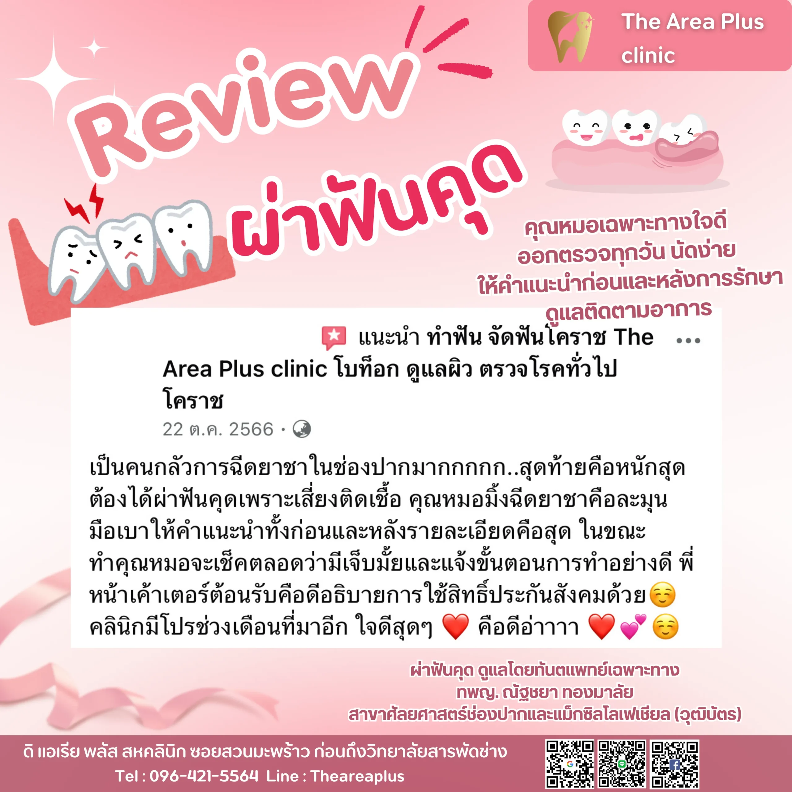 ผ่าฟันคุด รีวิวผ่าฟันคุด