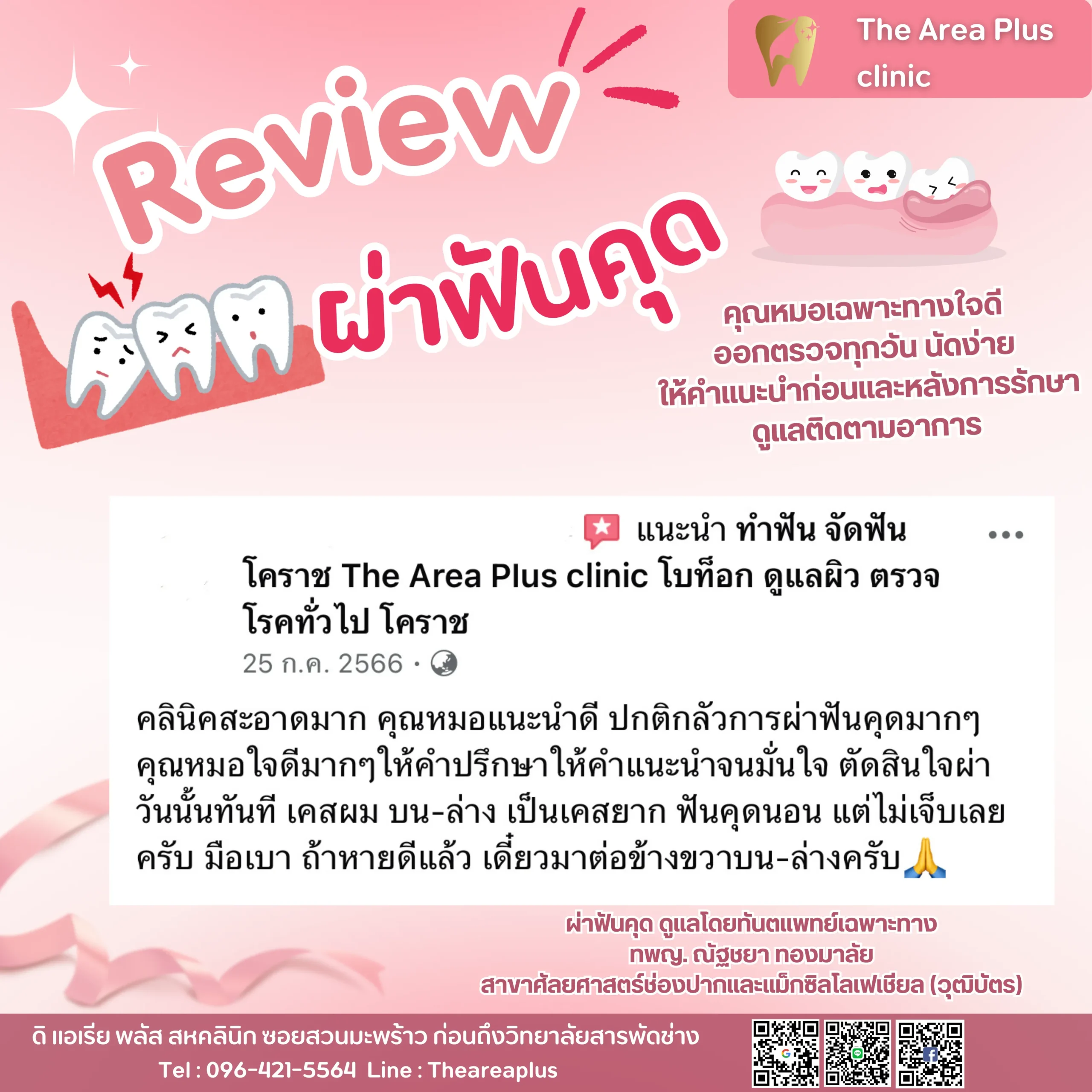 ผ่าฟันคุด รีวิวผ่าฟันคุด
