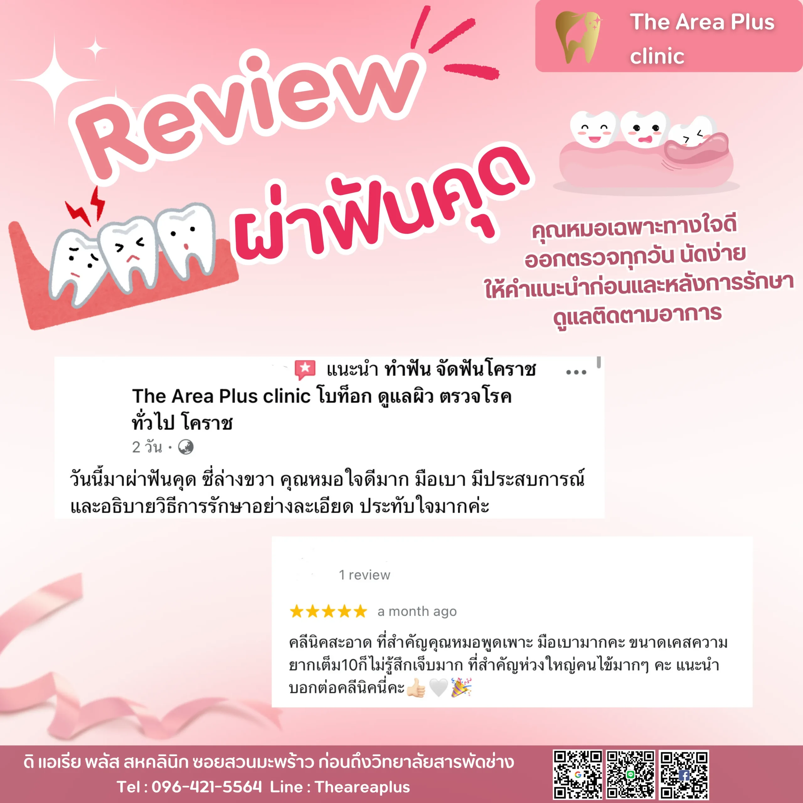 ผ่าฟันคุด รีวิวผ่าฟันคุด.zip - 8_result