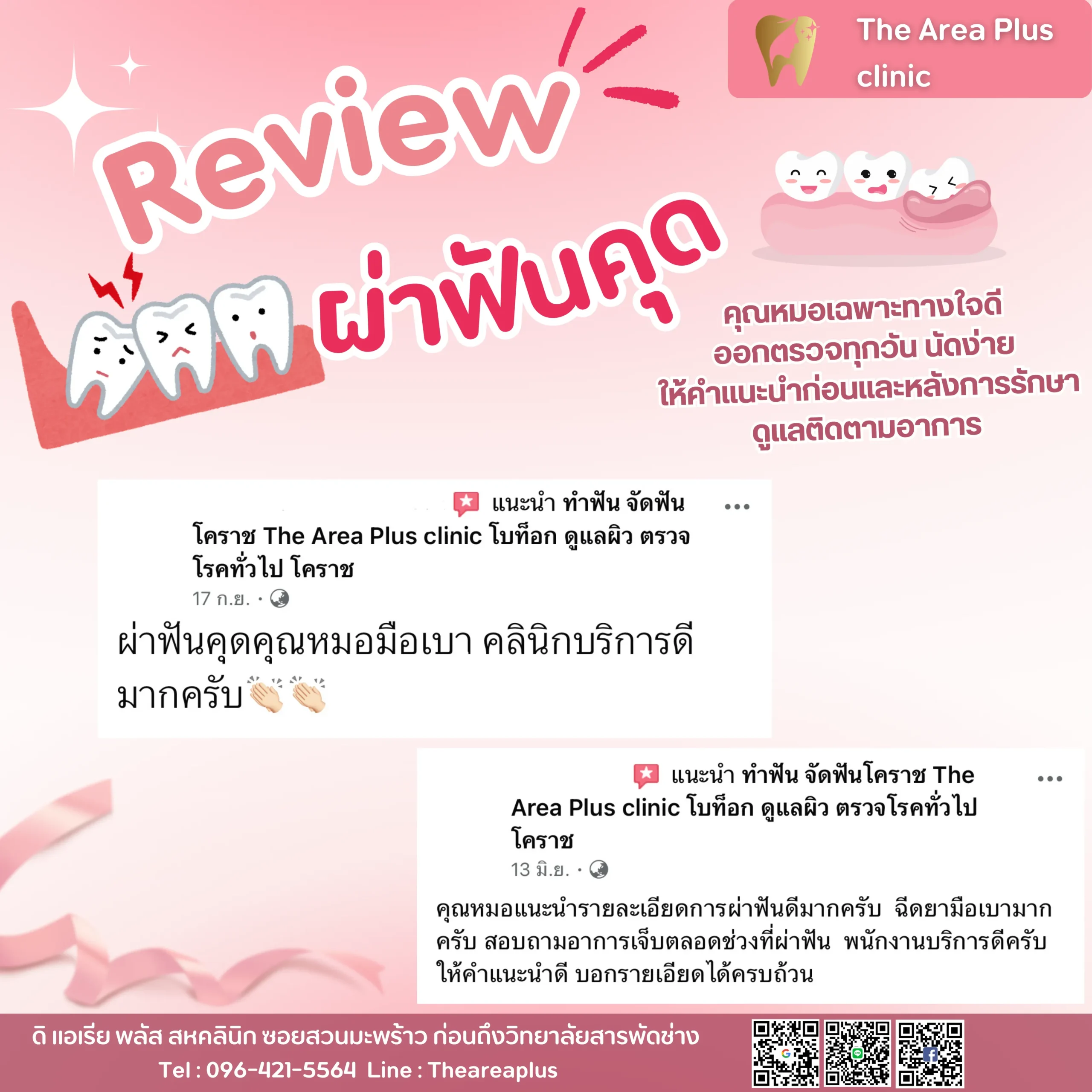 ผ่าฟันคุด รีวิวผ่าฟันคุด.zip - 9_result
