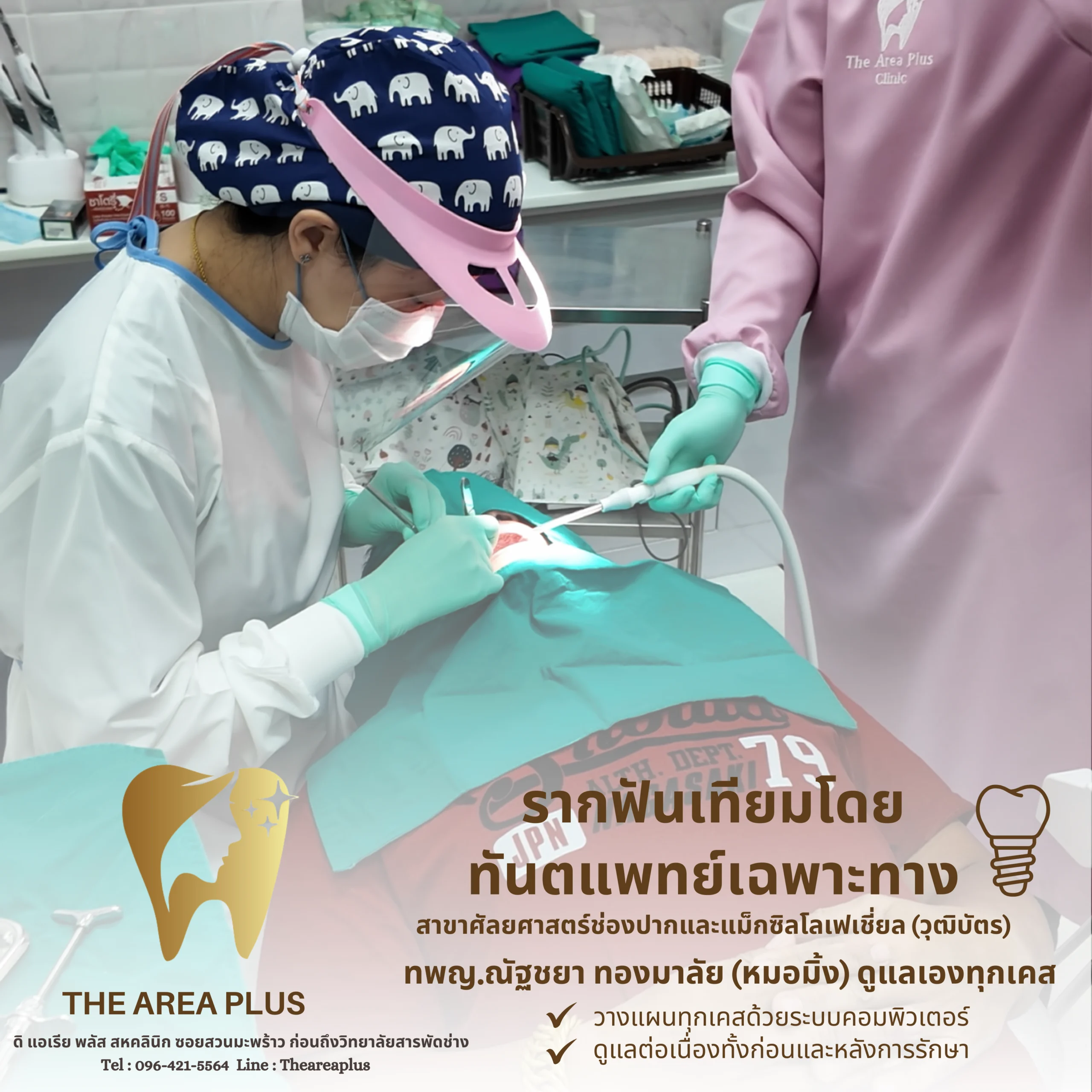 บริการรากฟันเทียมโคราช โดยทันตแพทย์เฉพาะทาง รีวิวรากฟันเทียมโคราช