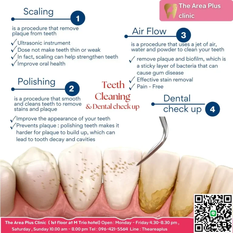 คลินิกทันตกรรมเฉพาะทางโคราช ขั้นตอนการทำความสะอาดฟันและตรวจสุขภาพฟัน