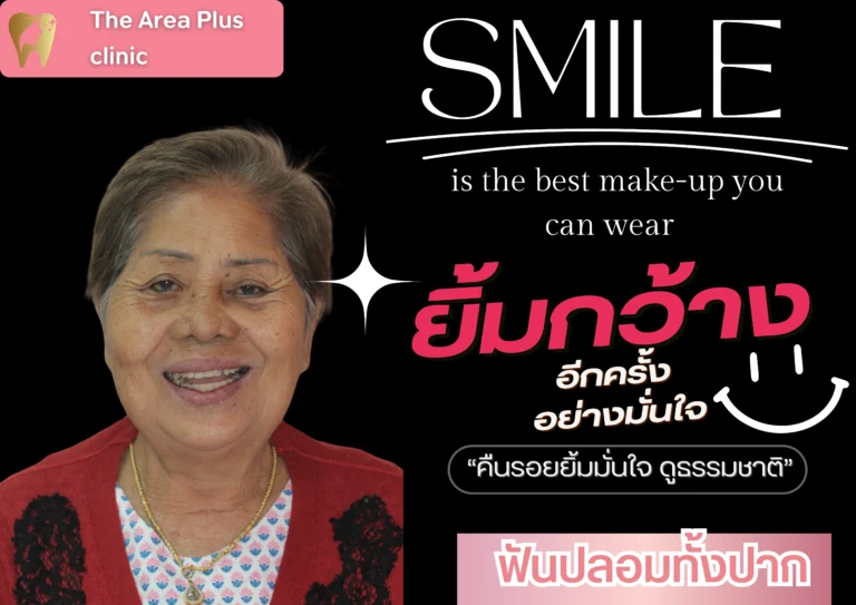 คลินิกทันตกรรมเฉพาะทางโคราช รีวิว ฟันปลอม The Area Plus Clinic