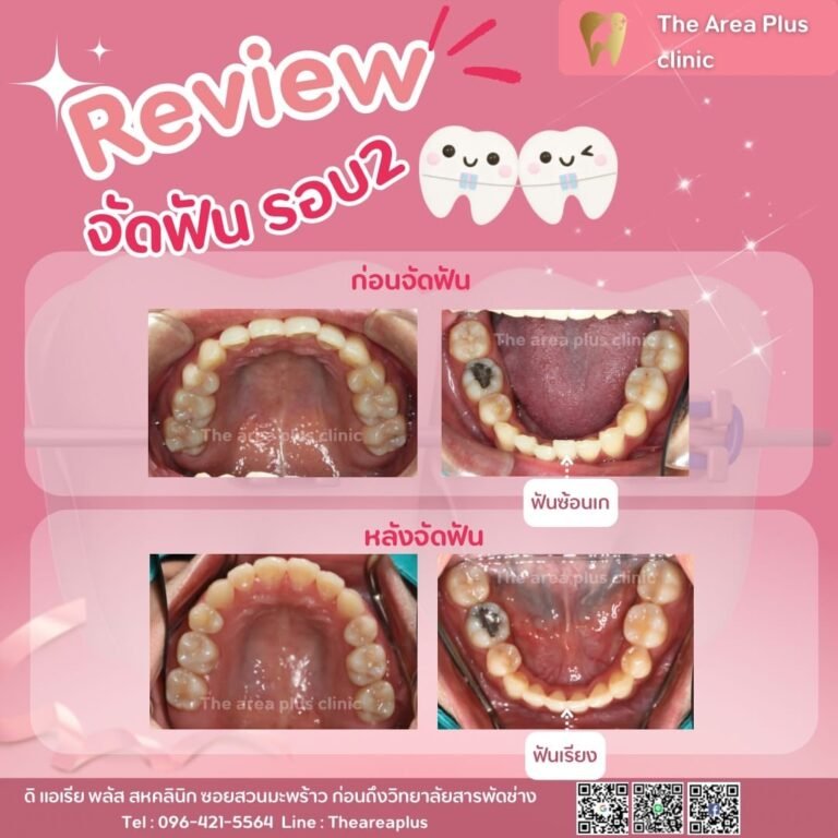คลินิกทันตกรรมเฉพาะทางโคราช 3a16c306-853a-4c74-9ed5-63ab1443ae1a