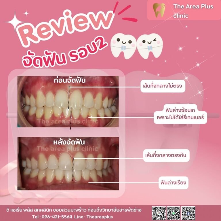 คลินิกทันตกรรมเฉพาะทางโคราช 3deaa5e7-a9d2-4abf-8e96-0f2d15f57d72