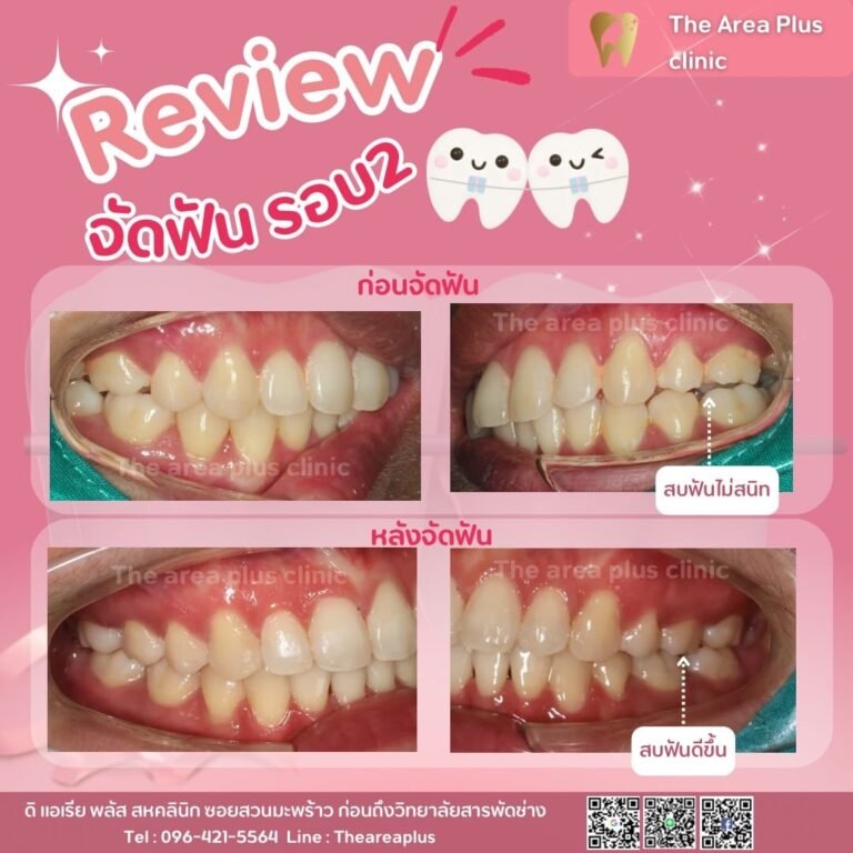 คลินิกทันตกรรมเฉพาะทางโคราช e1cc2fab-4ea2-4347-9531-7a88d7a4ee14