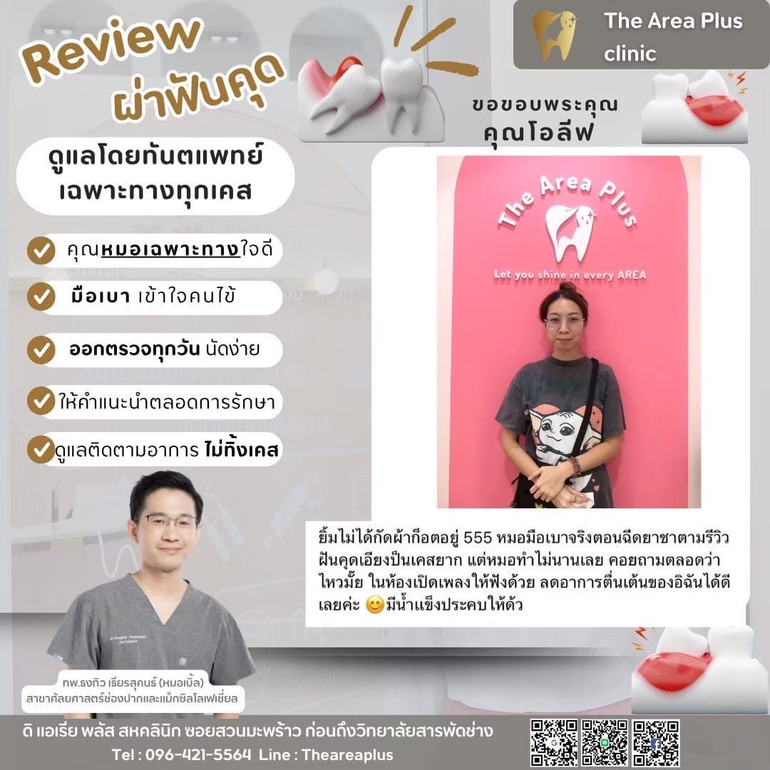 ผ่าฟันคุด 1c3aec68-6381-4cba-aac0-97230746f5ab