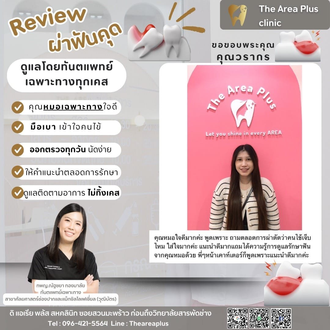 ผ่าฟันคุด 35306df5-64fb-487d-ac6f-90f26392f0ba