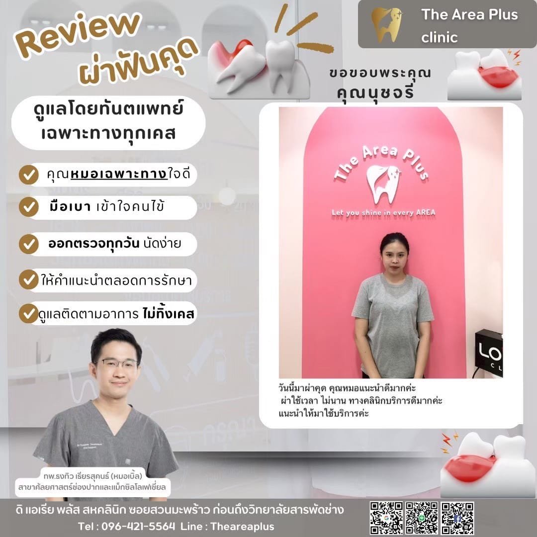 ผ่าฟันคุด 5a0e224b-a65b-4112-ad1f-7d784d37ca8d