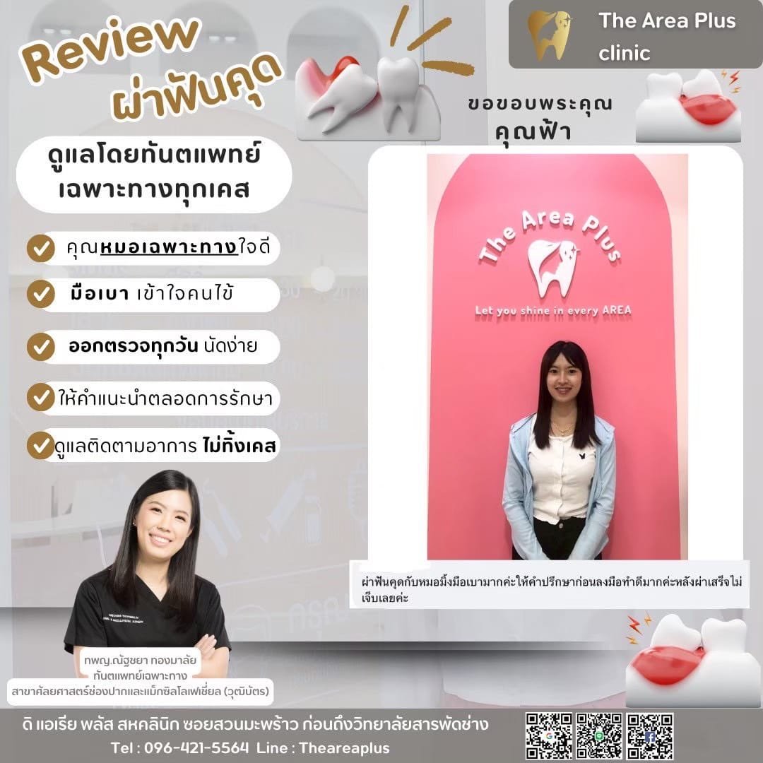 ผ่าฟันคุด add98b11-72b3-44cc-8948-9b94faf73432