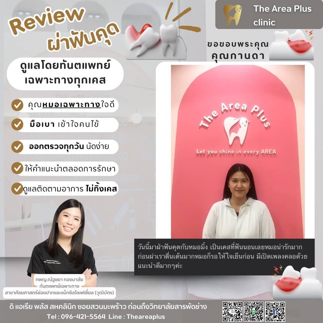 ผ่าฟันคุด 2294a18a-5e2a-4500-8405-77649b0204f6