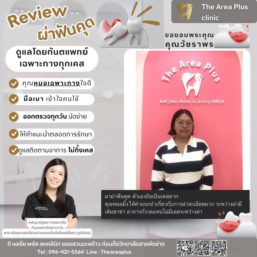 ผ่าฟันคุด 309a1c4a-4b23-4a6d-a9d5-694ae6283b62